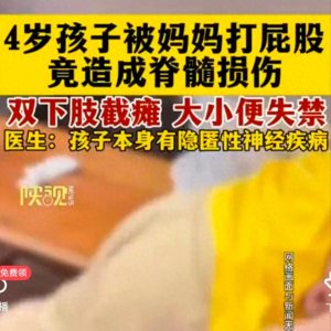 ​四岁孩子被妈妈打屁股后脊髓损伤，下肢瘫痪，孩子到底能不能打