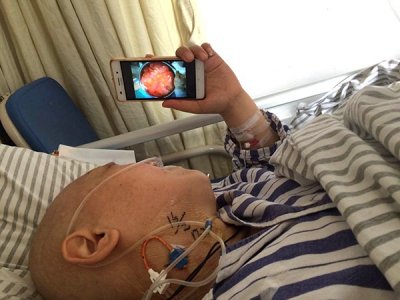 ​女子肚大以为肥胖 不知巨大肿瘤几乎挤满腹腔