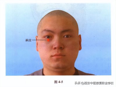 ​足阳明胃经经穴——承泣