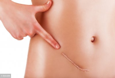 ​宫颈肥大是怎么回事 需