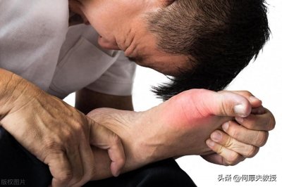 ​痛风11种常用药，哪种最管用？