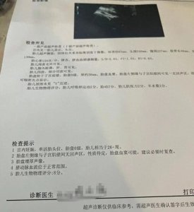 ​孕妇坐动车，怀胎7月的