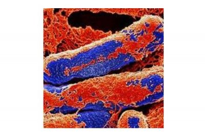 ​世界十大最毒东西排行